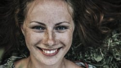 Rahasia Menghilangkan Bintik-bintik Cokelat di Kulit Secara Alami