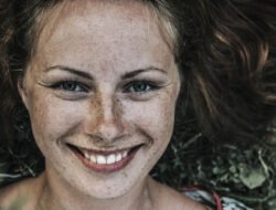 Rahasia Menghilangkan Bintik-bintik Cokelat di Kulit Secara Alami